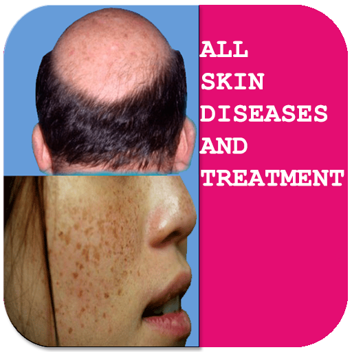App Insights Skin Diseases And Treatment Of Apptopia