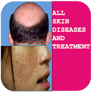 Skin diseases and treatment offline