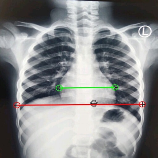 CT Ratio-Xray logo
