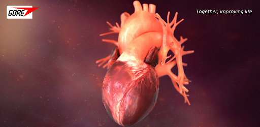 Gore Cardioform