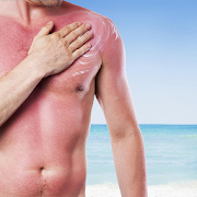Top 38 Lifestyle Apps Like How to Treat a Sunburn - Best Alternatives