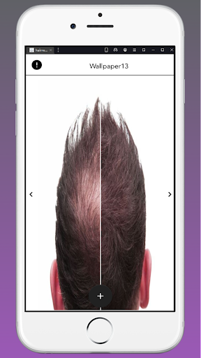 Hairrestoration wallpaper Screen 3