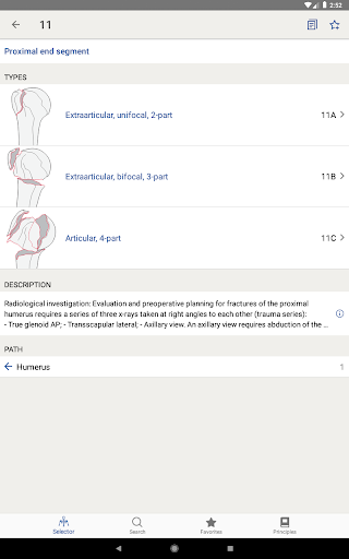 AO-OTA Fracture Classification