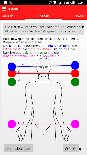 CMD Verdachtsdiagnose für Zahn Screen 3