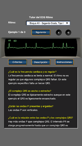 Tutor del ECG Ritmo