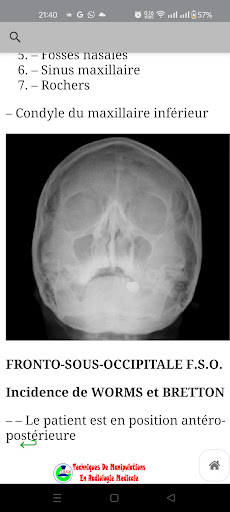 Radiologie Medicale Pro screenshot 11