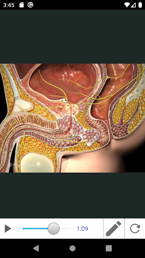 Benign Prostatic Hyperplasia Screen 3