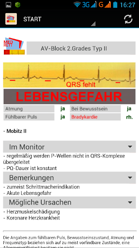 EKG-Monitoring
