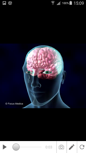 Schizophrenia Screen 3