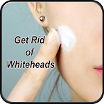 Cover Image of Unduh Get Rid Of Whiteheads  APK