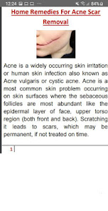 Acne Scar Removal 1.1 APK + Mod (Free purchase) for Android