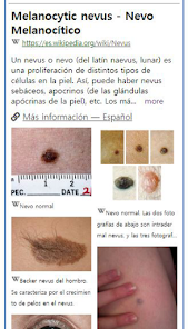 Captura de Pantalla 2 ModelDerm–Enfermedades la piel android