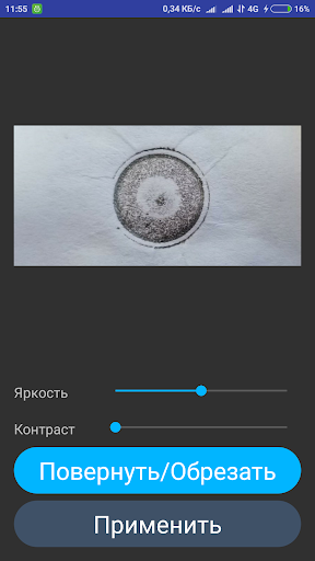 Тонометрия по Маклакову Screen 3