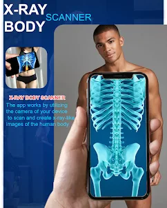 X-ray Body Scanner Cloth Cam
