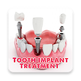 Tooth Implant Treatment icon