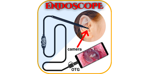 Endoscope APP for android - En – Applications sur Google Play