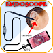 Endoscope Camera Ear USB & Cam - Androidアプリ