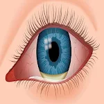 Common Eye Diseases Apk