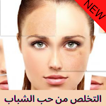 Cover Image of Download التخلص من حب الشباب 1 APK
