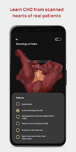 Congenital heARts