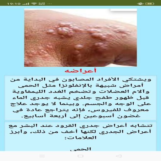 Android application جدري القرود screenshort