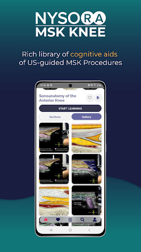 NYSORA MSK US Knee App Screen 2