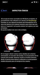 Captura 4 Hombro android
