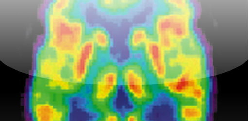 Radiology Core: Nuclear Med