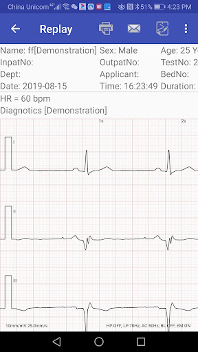 aECG Screen 3
