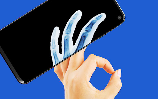 Android application X-ray scan tool photo filter screenshort