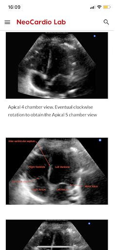 NeoCardioLab Screen 2