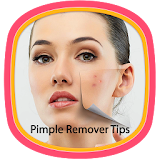 Pimple Remover Tips icon
