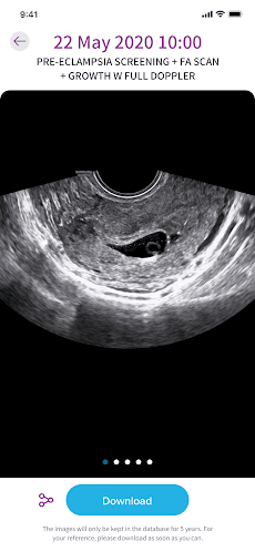 Ultragramのおすすめ画像4