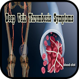 Deep Vein Thrombosis Symptoms icon