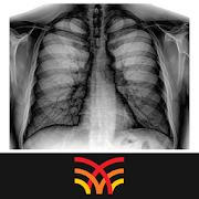 Chest Radiographs  Icon