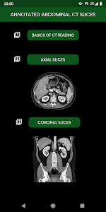 abdominal CT: annotated slices Unknown