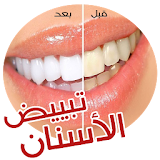 وصفات تبييض الاسنان في أسبوع icon
