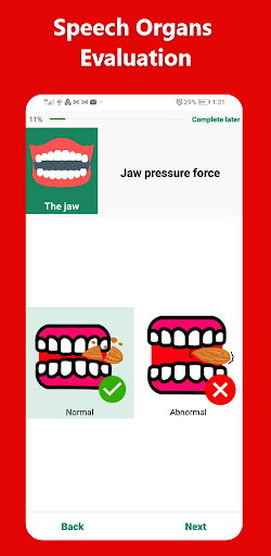 Talky – For Non Verbal People