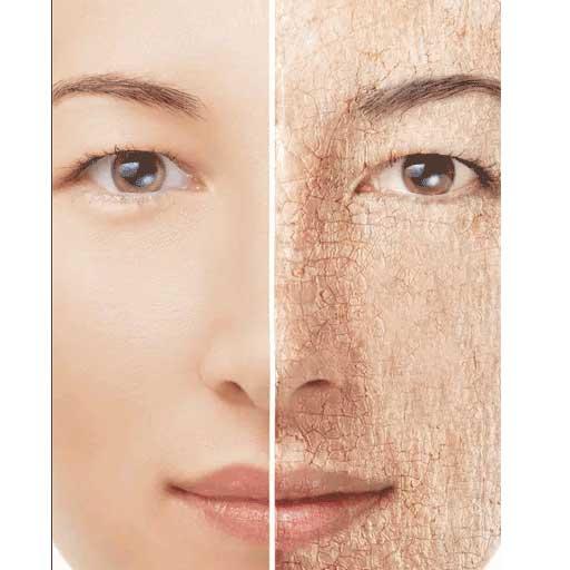 App Insights Dry Skin Causes And Solutions Apptopia