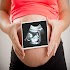 Pregnancy and ultrasound guide