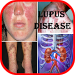 Cover Image of ダウンロード Lupus: Causes, Diagnosis, and  APK