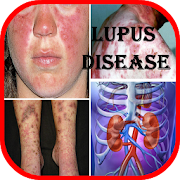 Top 36 Medical Apps Like Lupus: Causes, Diagnosis, and Treatment - Best Alternatives