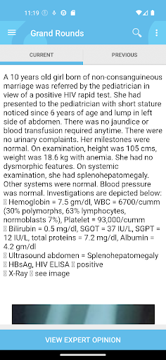 HIV In Children Screen 3