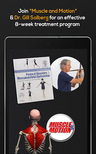 Screenshot of Kyphosis & Rounded Back by M&M