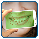 Teeth Bacteria Scanner Prank icon