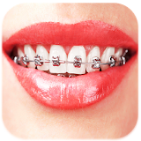 Braces: Real Teeth Braces Pict icon