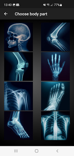 X-ray Scanner Screen 2