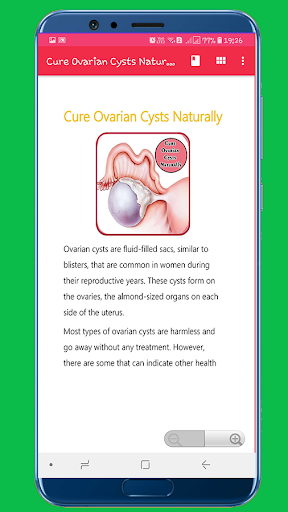 Cure Ovarian Cysts Naturally