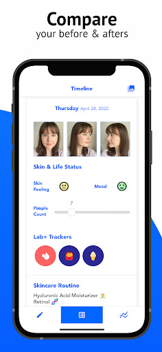 SkinTheory Skin + Acne Tracker screenshot