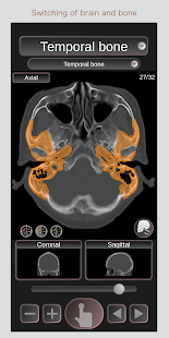 Ct Passport Head Brain Sectional Anatomy Mri Google Play Də Tətbiqlər